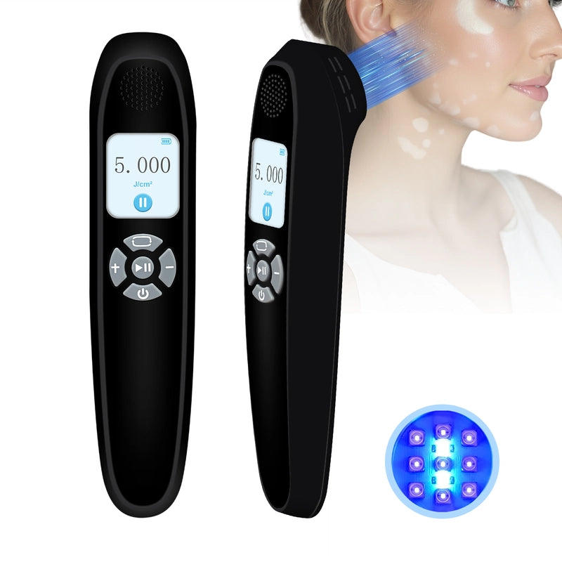 Portable 308nm UVB Phototherapy Device – Effective for Vitiligo & Psoriasis at Home