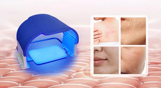 Blue Light Therapy: How It Heals Your Skin and Helps Regain Even Tone