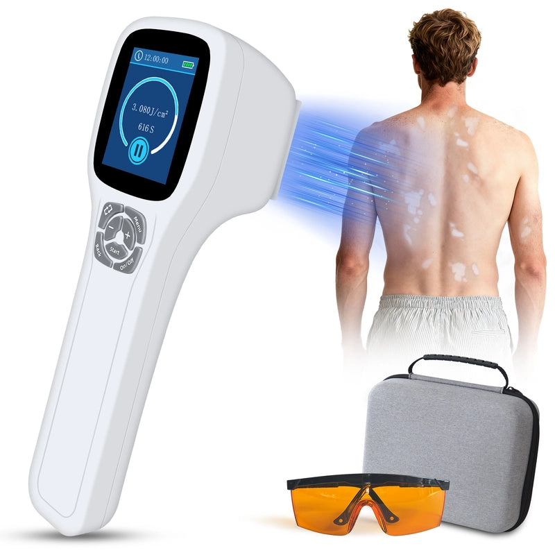 Handheld 308nm Laser UVB Light Therapy At Home For Vitiligo and Psoriasis