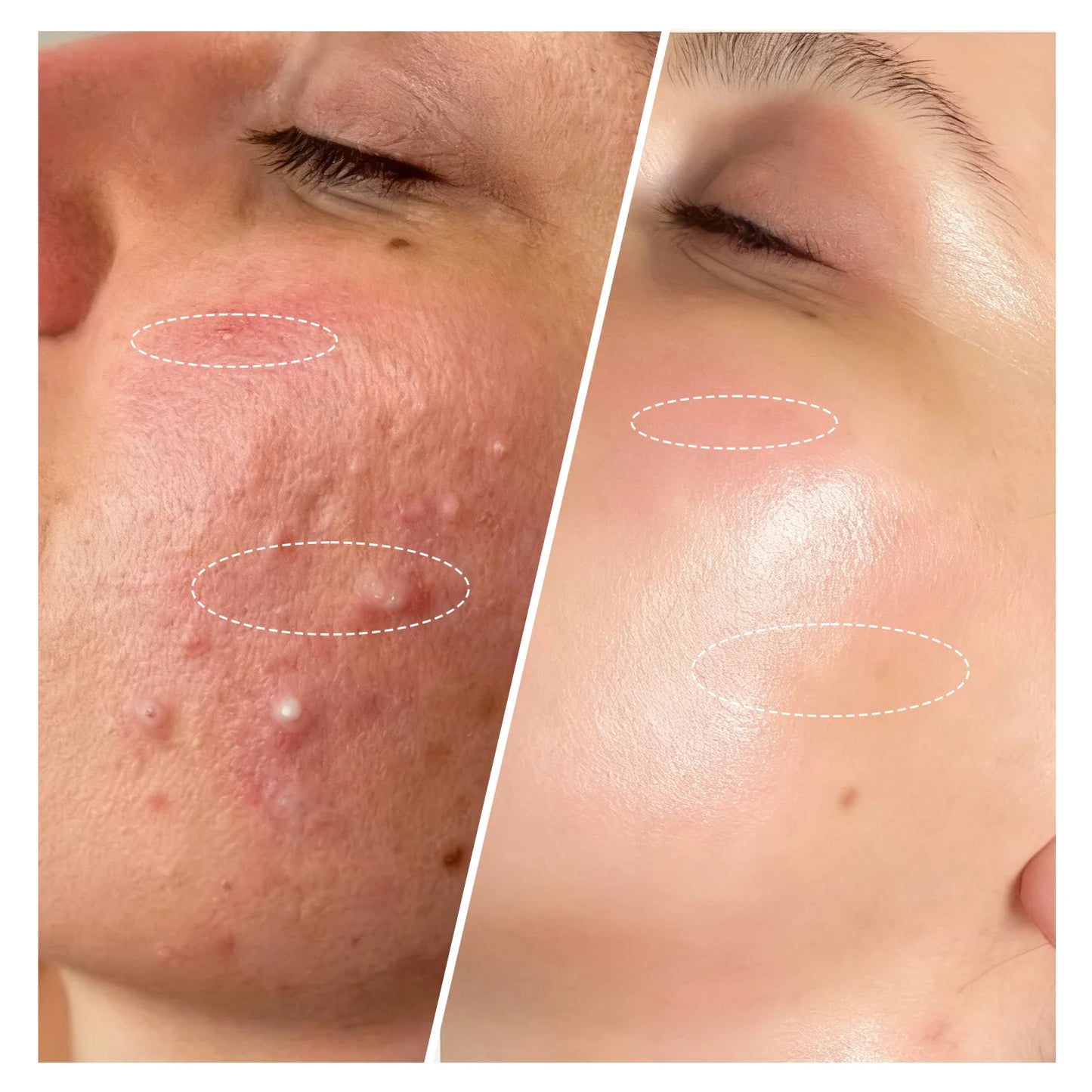 LED Red and Near-Infrared Light Therapy Face Mask for wrinkle, anti-aging