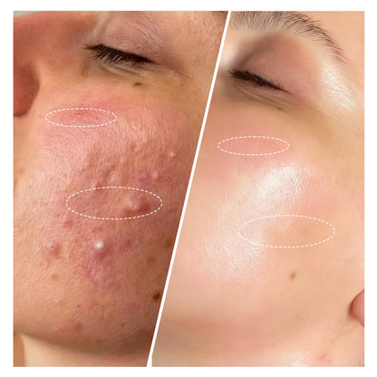 LED Red and Near-Infrared Light Therapy Face Mask for wrinkle, anti-aging