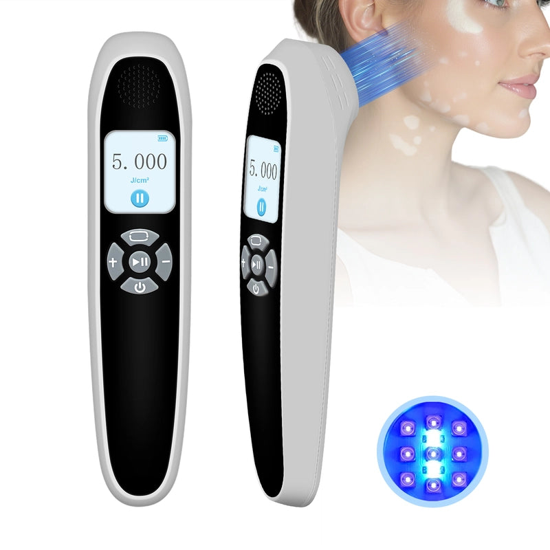 Portable 308nm UVB Phototherapy Device – Effective for Vitiligo & Psoriasis at Home