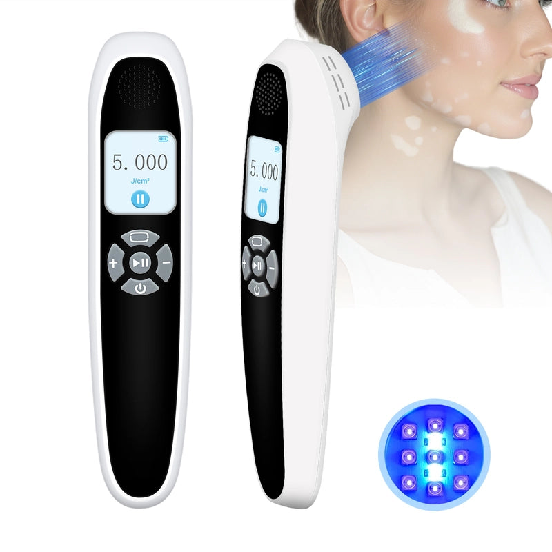 Portable 308nm UVB Phototherapy Device – Effective for Vitiligo & Psoriasis at Home