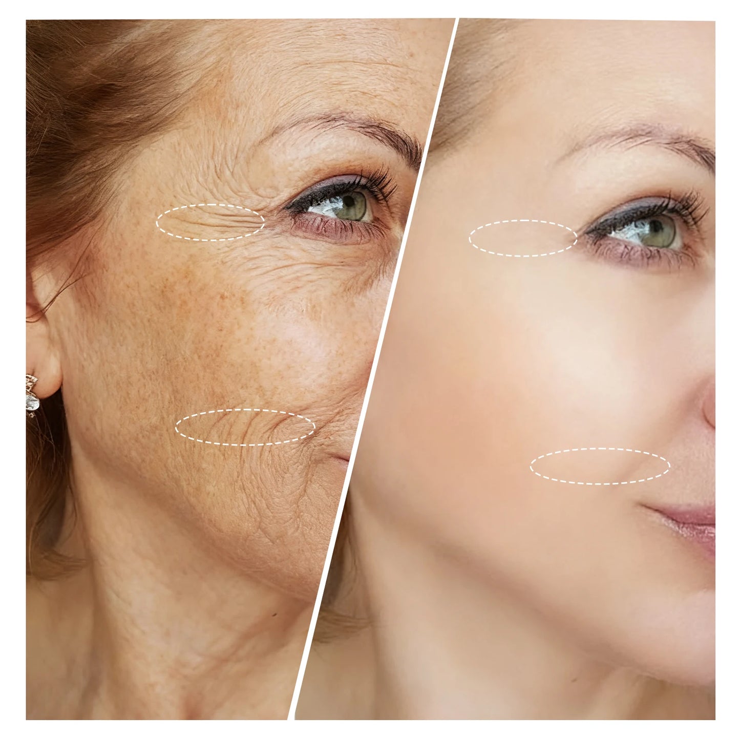 LED Red and Near-Infrared Light Therapy Face Mask for wrinkle, anti-aging