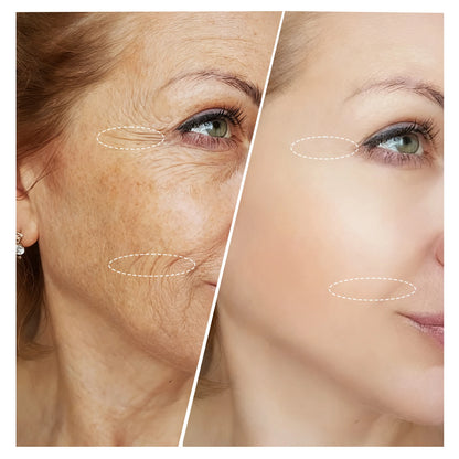 LED Red and Near-Infrared Light Therapy Face Mask for wrinkle, anti-aging