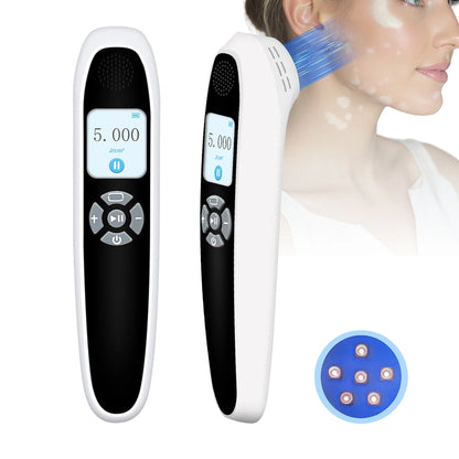 Portable 308nm UVB Phototherapy Device – Effective for Vitiligo & Psoriasis at Home